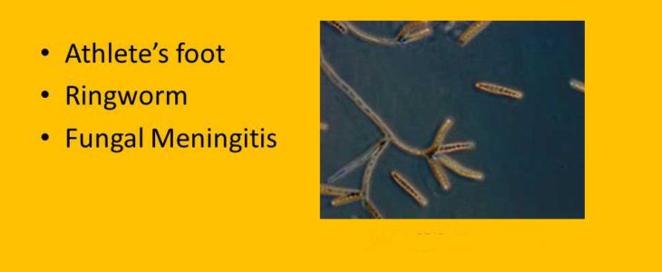 Disease Caused By Fungi In Human Body  मानव शरीर मे फफूंद से होने वाले रोग