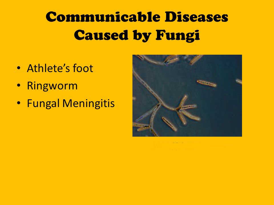 disease-caused-by-fungi-in-human-bodys
